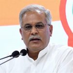 अमेरिकन पॉप सिंगर मैडोना की हालत गंभीर, बैक्टीरियल इंफेक्शन की वजह से बिगड़ी तबियत