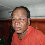 आबकारी घोटाला मामला : चैतन्य बघेल को नहीं मिली राहत, हाईकोर्ट में टली सुनवाई